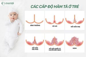 Các cấp độ hăm tã ở trẻ