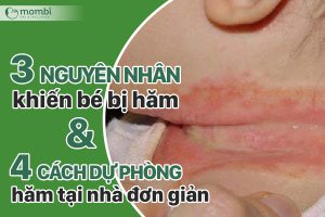 Nhanh tay ghi lại 3 nguyên nhân khiến bé bị hăm và 4 cách phòng hăm hiệu quả tại nhà, mẹ ơi!