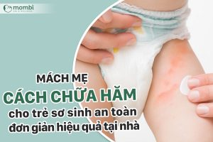 Mách mẹ cách chữa hăm cho trẻ sơ sinh an toàn đơn giản hiệu quả tại nhà